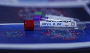 The first Coronavirus test for asymptomatic individuals has been approved 128