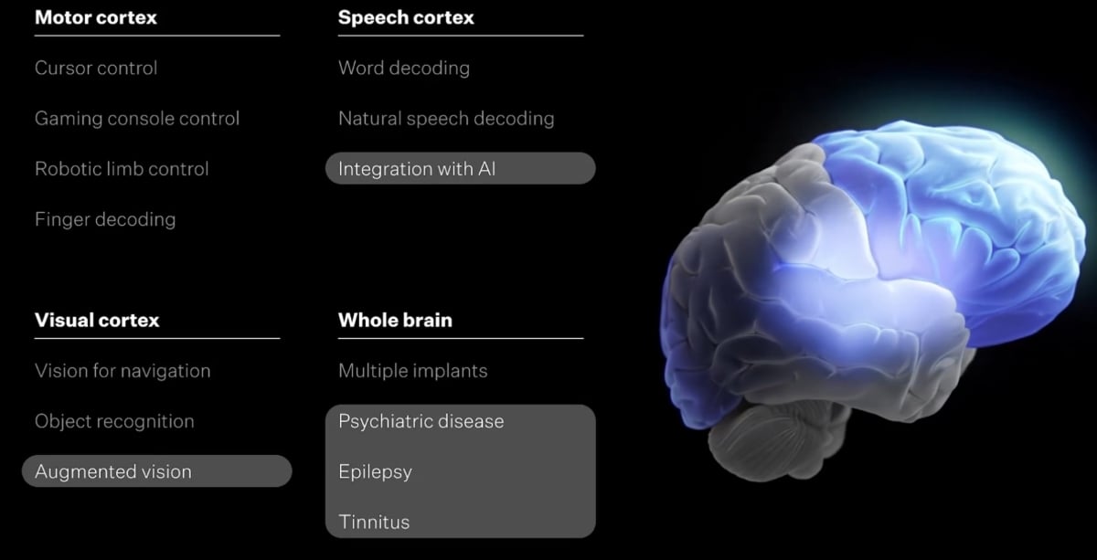 Neuralink's brain chip 