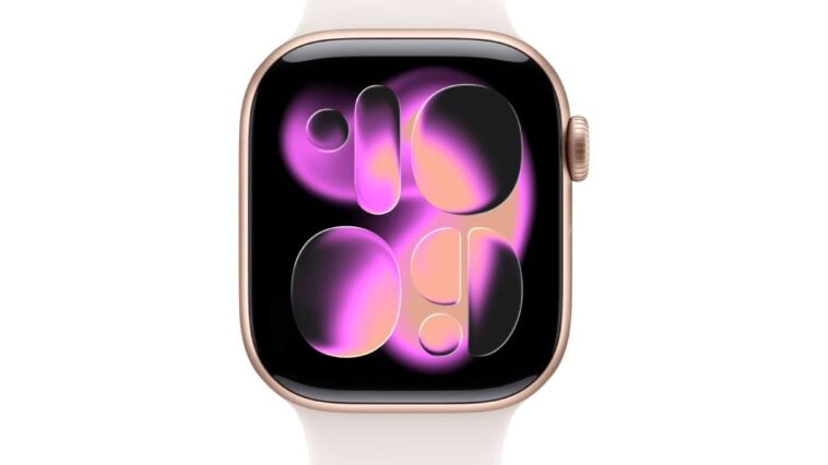 Apple Watch Series 11 ©Image Credit: Apple