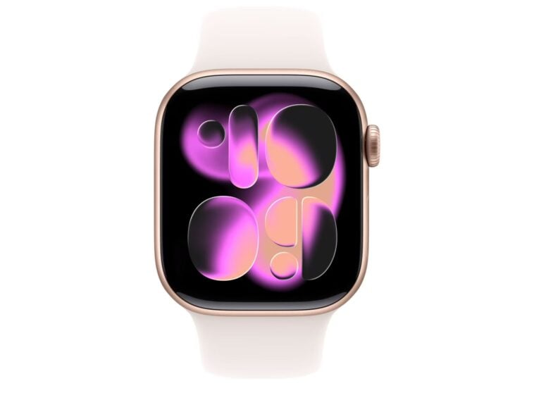 Apple Watch Series 11 ©Image Credit: Apple