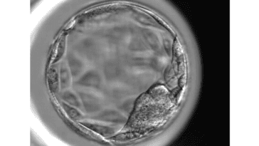 Human blastocyst at around day 5 of development. The experiment is studying early embryo models similar to this stage | ©Image Credit: Peter Michael Kragh, via lex.dk / CC BY-NC-SA 3.0)