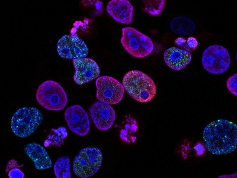Researchers have treated the first patient in a trial testing whether aging cells can be made young again | ©Image Credit: Unsplash / CDC