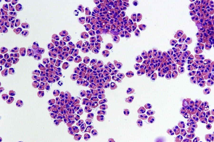 Scientists discover a state between life and death 2 Human white blood cells are examples of low-energy cells that can remain active for up to 86 hours postmortem. ©Image Credit: Wikicommons / National Center for Advancing Translational Sciences