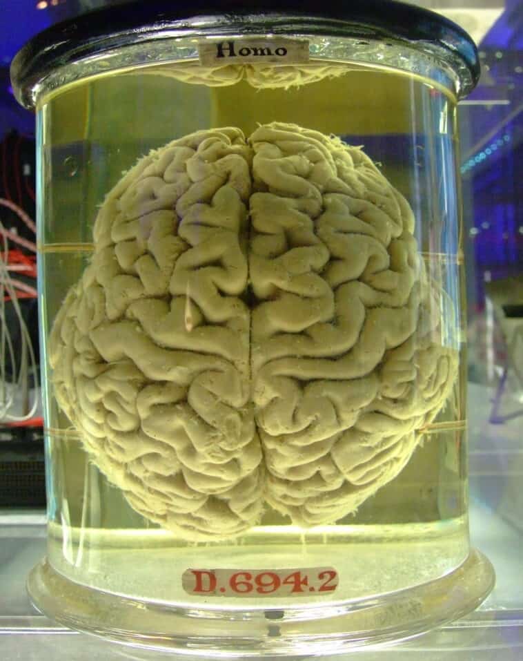 Scientist says only one thing truly exists: consciousness 1 Neuroscientist Christof Koch is challenging traditional science, suggesting the brain doesn't generate your thoughts—it just shapes an underlying universal field of awareness. ©Image Credit: Wikicommons / Gaetan Lee